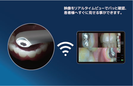 Wi-Fi経由でどこでもカンタン接続