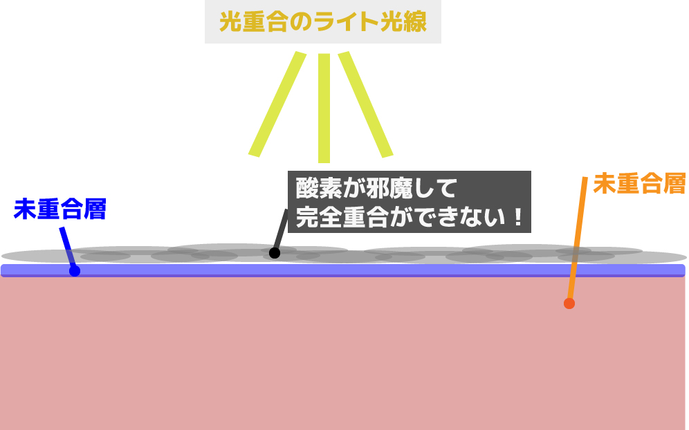 「未重合層」はなぜ生まれる？