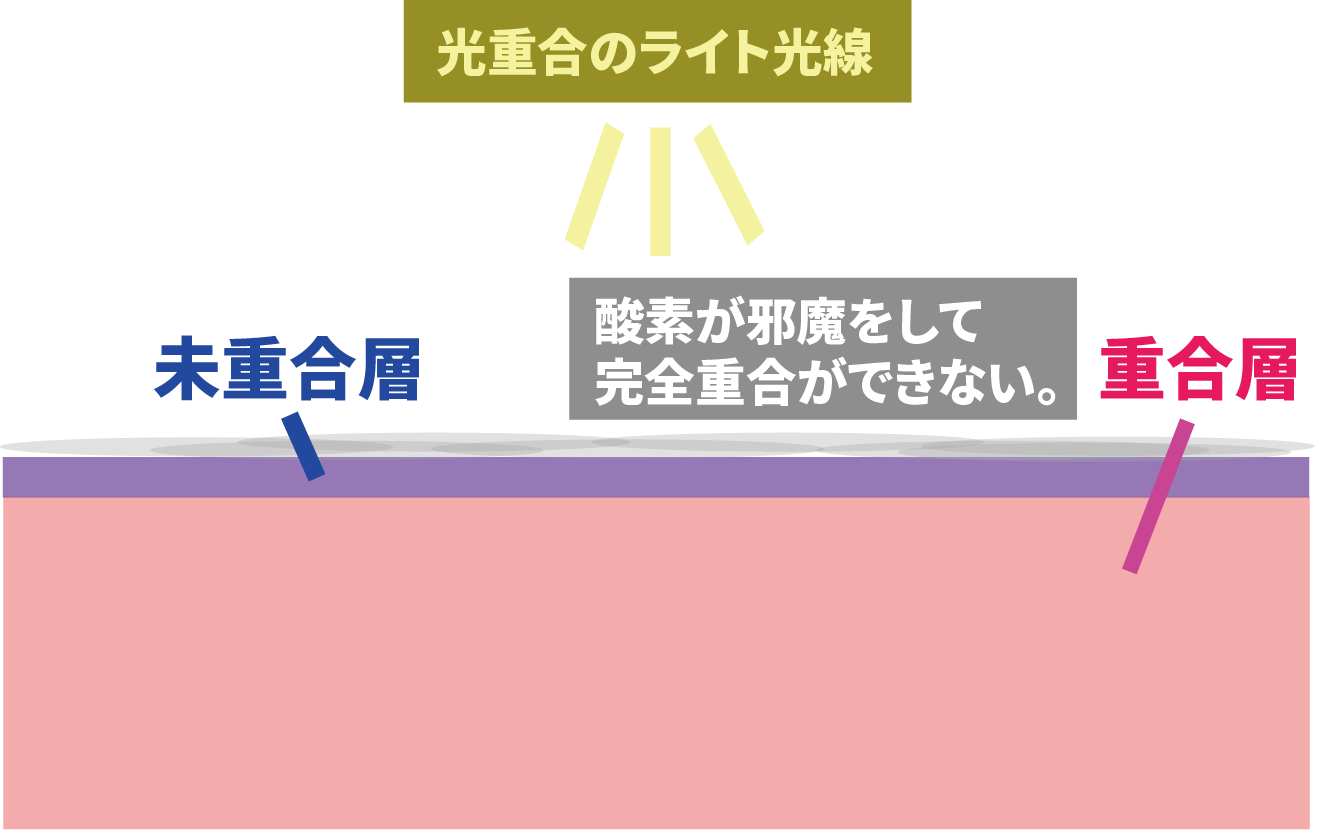 「未重合層」はなぜ生まれる？