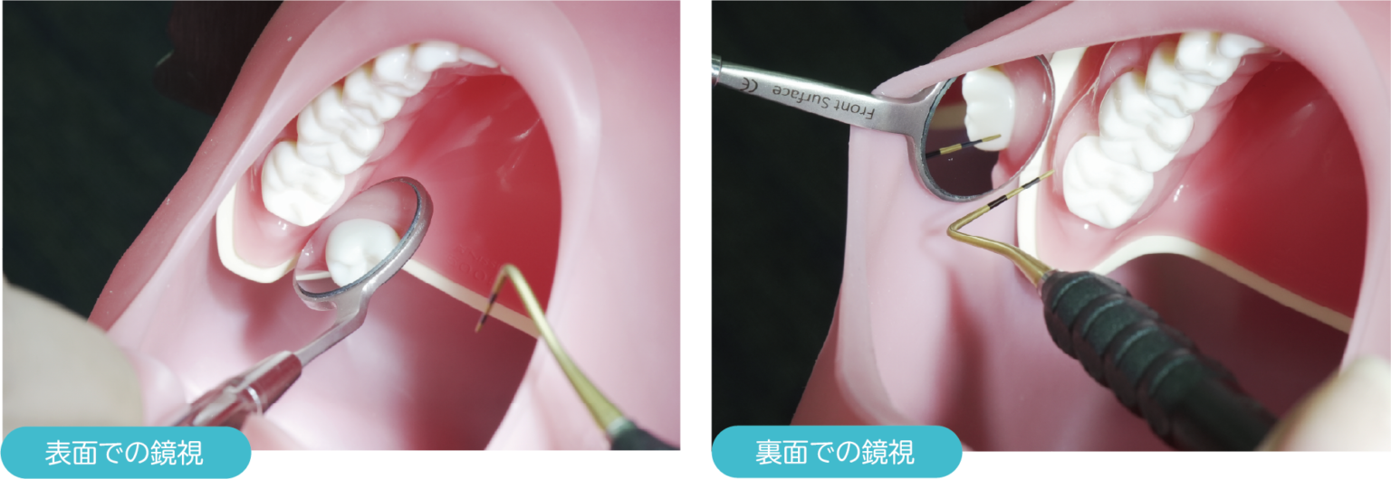 デンタルミラー「スリムネック両面ミラー」の販売開始 名南歯科貿易株式会社 Meinan Dental Trading Co., Ltd.
